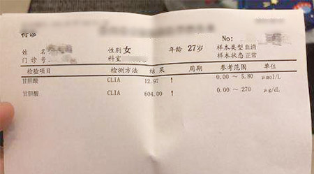 甘胆酸偏高图片