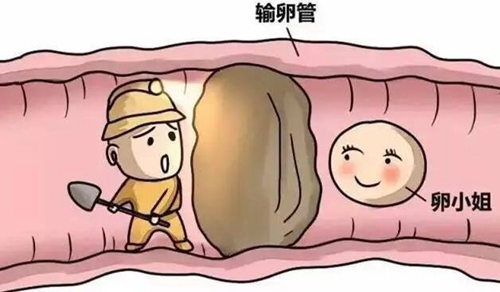 输卵管疏通手术