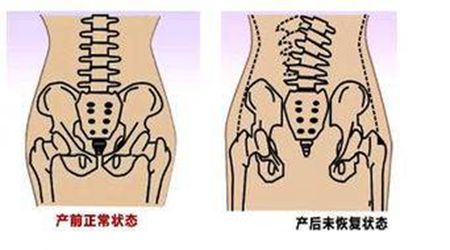 产后修复多少钱